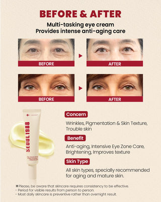 SEOUL 1988 Eye Cream su 4 % Retinal Liposome + fermented bean - Paakių kremas senstančiai odai 30ml