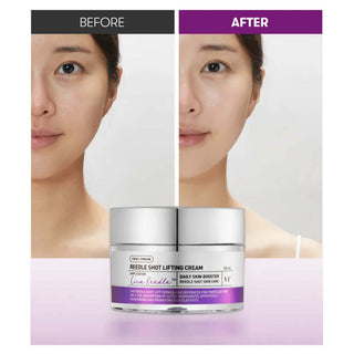 VT REEDLE SHOT LIFTING CREAM - Stangrinantis veido kremas su mikroadatėlių technologija 50ml
